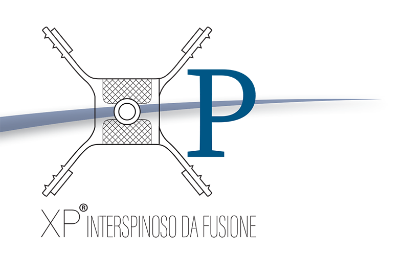 XP SISTEMA DI STABILIZZAZIONE INTERSPINOSA