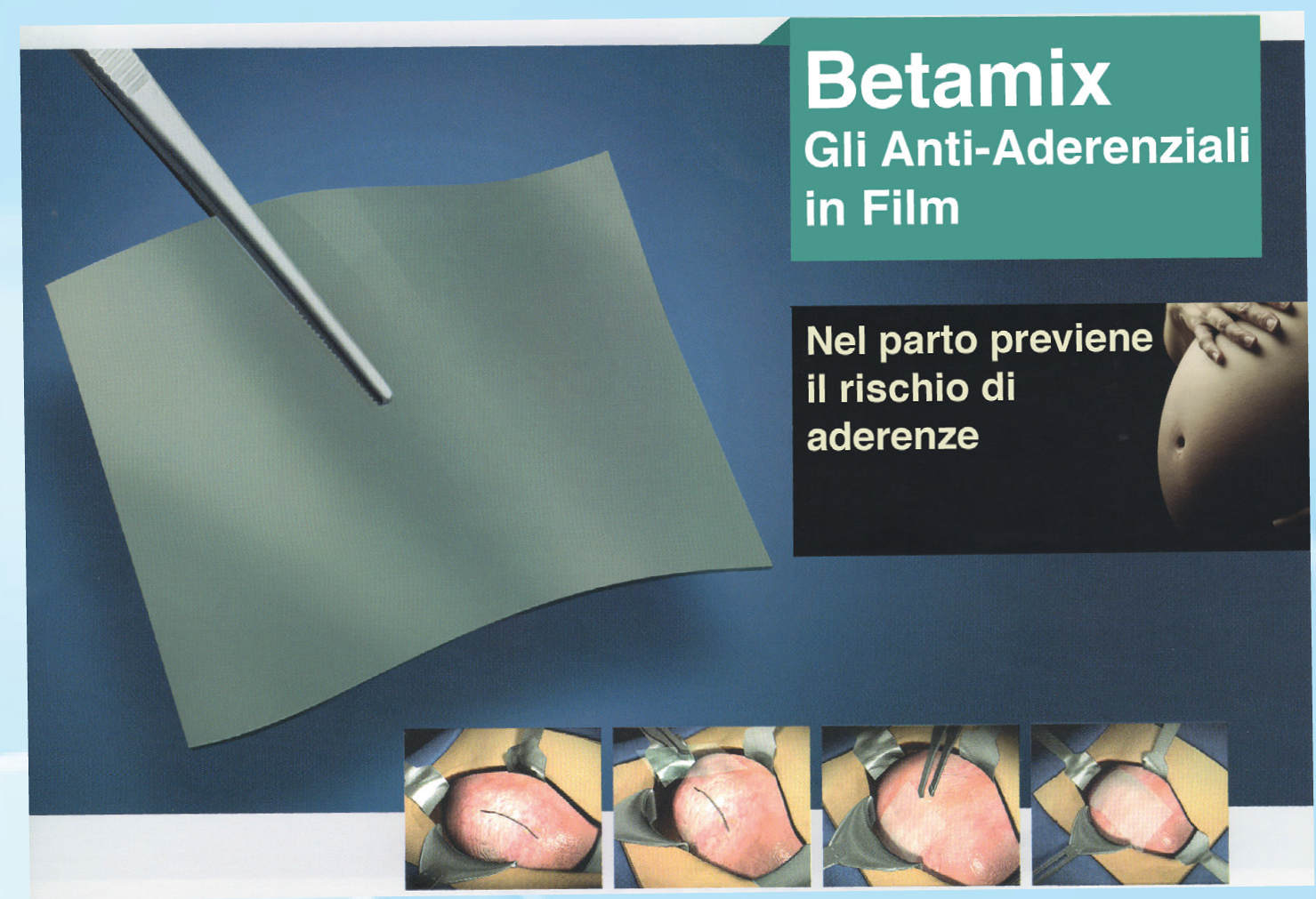 BEtamix - Anti Aderenziali